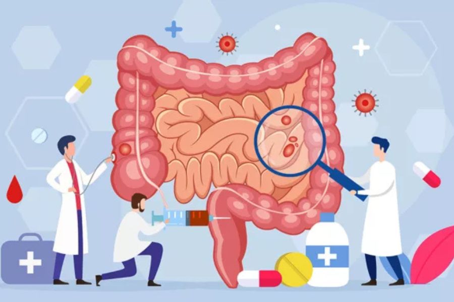 Probiotics for Gut Health